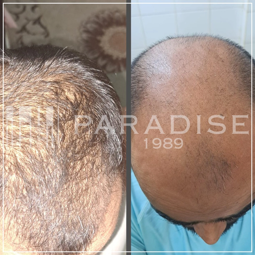 Result photo shared by Ravi P.