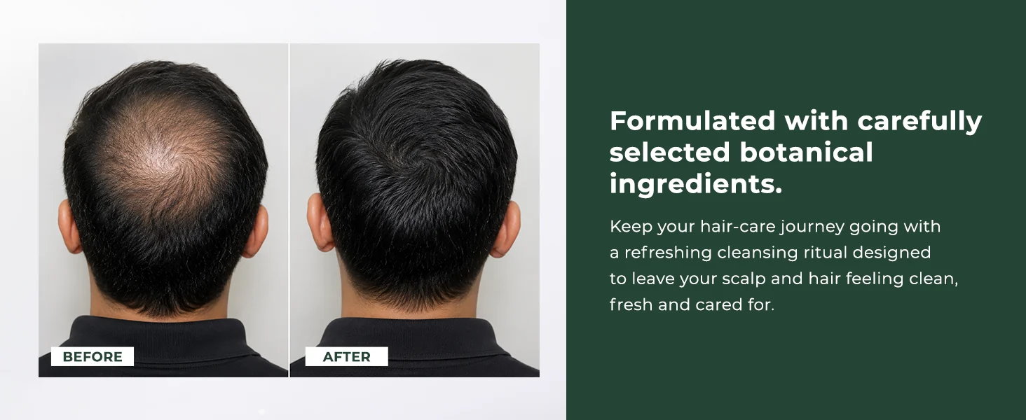 Before and after scalp comparison alongside the botanical ingredient statement