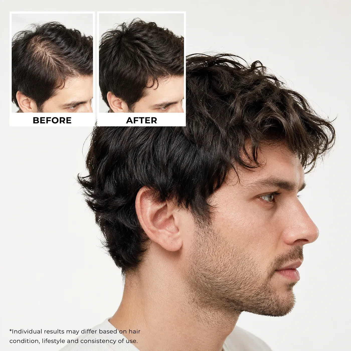 Neo Hair Shampoo bottle styled with ginseng root and rosemary sprigs on a pale surface